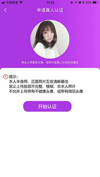 小激动 v2.1.4