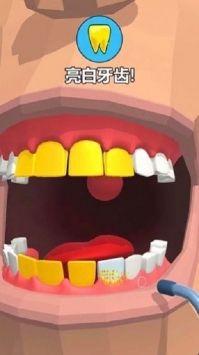 拔牙大师中文汉化版