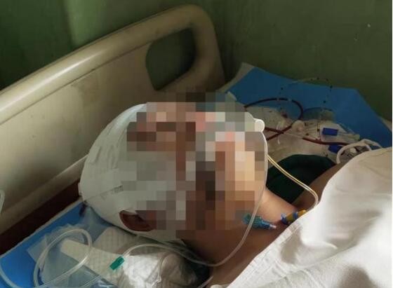 涉事老师回应男生被打后颅内血肿:承认打人,头是他下跪磕伤的