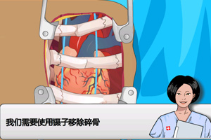 现代医院心脏手术手游