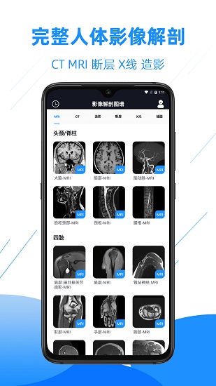 医学影像解剖图谱 v4.2.0 安卓版